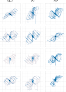 Example time continuous scatter plots of multiple OLD, PD and PSP participants.